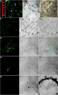 Identification of PSD-95 in the Postsynaptic Density Using MiniSOG and EM Tomography